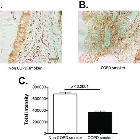 Fabp Expression Is Decreased In Copd Airway Epithelial Cells A