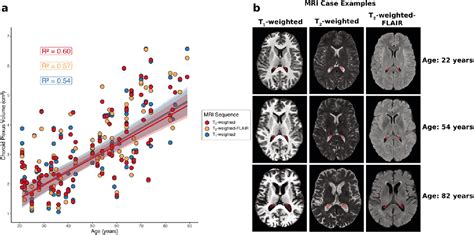 Figure 6 From Deep Learning Segmentation Of The Choroid Plexus From