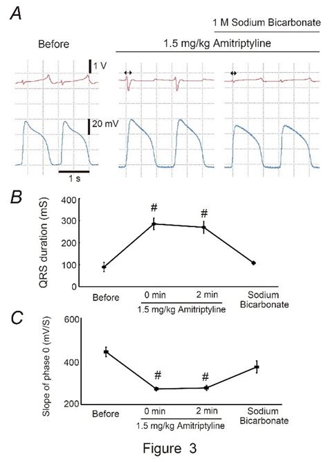 三環系抗うつ薬（アミトリプチリン）中毒で起きる心電図変化とそのメカニズムを明らかに看護学群・風間教授が卒業研究の4年生と 公立大学法人