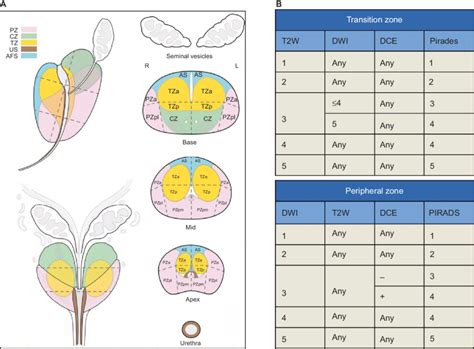 PIRADS v2. Notes: (A) Thirty-nine zones of prostate; Reproduced from ...