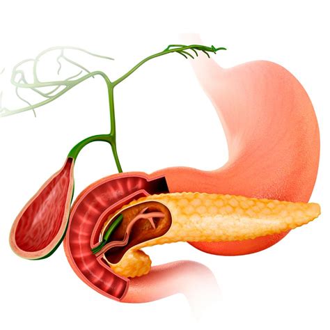 pancreas liver  pancreatic transplant surgeon  dubai