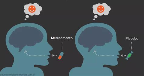 O Efeito Placebo Funciona Porquê Traumatologia E Ortopedia