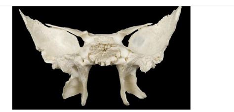 solved identify  bone   image cheggcom