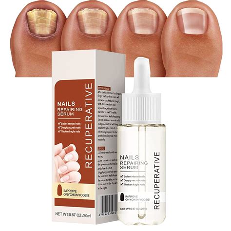 Amazon.com : 7 Days Nail Growth and Strengthening Serum, Nail ...