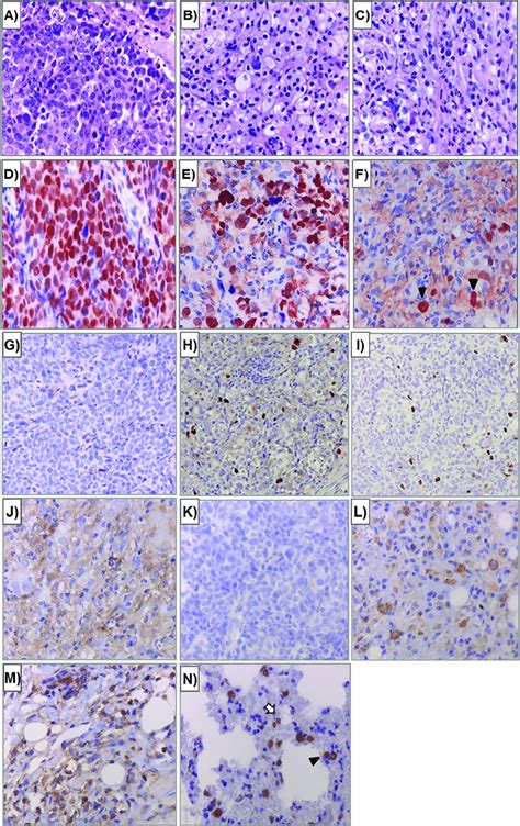 Hematoxylin And Eosin He Staining A C And Eber In Situ