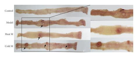 Colonic Morphology And Tumor Burden In Different Groups At The 24th