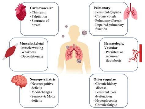 Pharmaceutics Free Full Text Post Covid Syndrome The Research