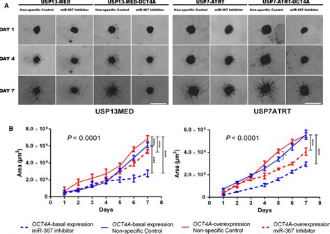 MiR367 Silencing Inhibits Embryonal CNS Tumor Spheroid Cell Invasion