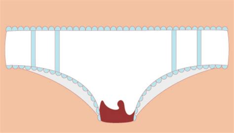 Menstruação borra de café o que é Possíveis causas e tratamentos