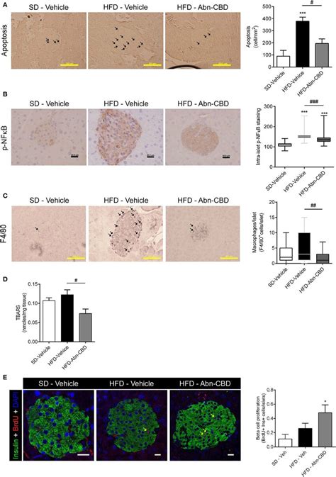 Effect Of Abn CBD On Pancreatic Beta Cell Viability And Intra Islet