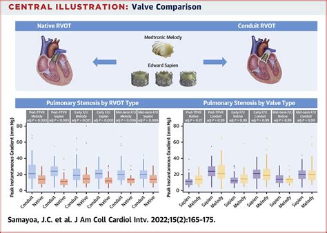 Echocardiographic Assessment Of Melody Versus Sapien Valves Following