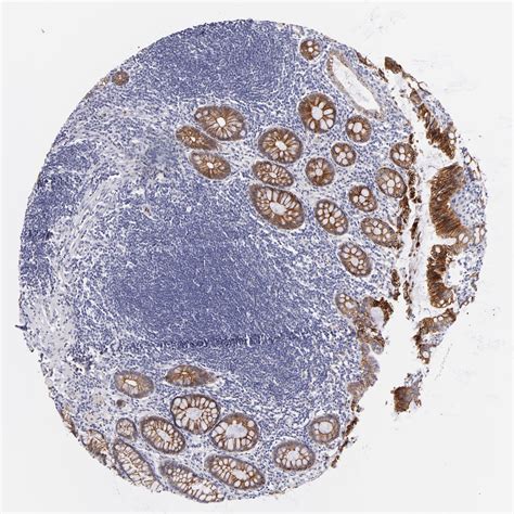 Tissue Expression Of Cdh Staining In Rectum The Human Protein Atlas