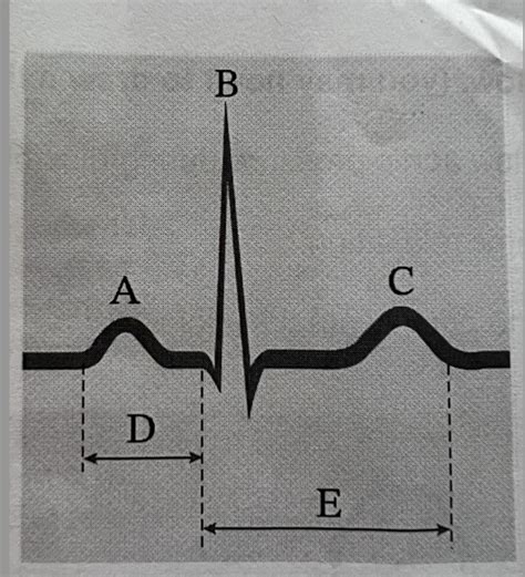 Ecg Diagram Quizlet