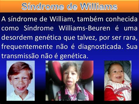 Síndrome De Williams Seminário De Biologia Celular E Molecular