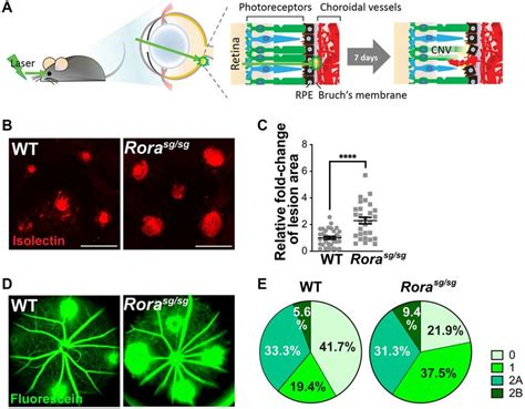 Genetic deficiency of RORα increased lesion size and vascular leakage