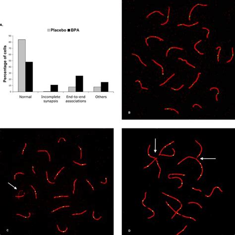 Pachytene Analysis A Frequency Of Synaptic Abnormalities In