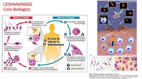 Clase Enfermedades Parasitarias Youtube