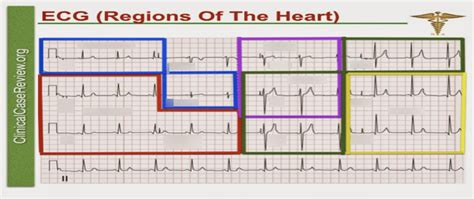 Block 4 ECG 1 Diagram: ECG Lead Localization Diagram | Quizlet