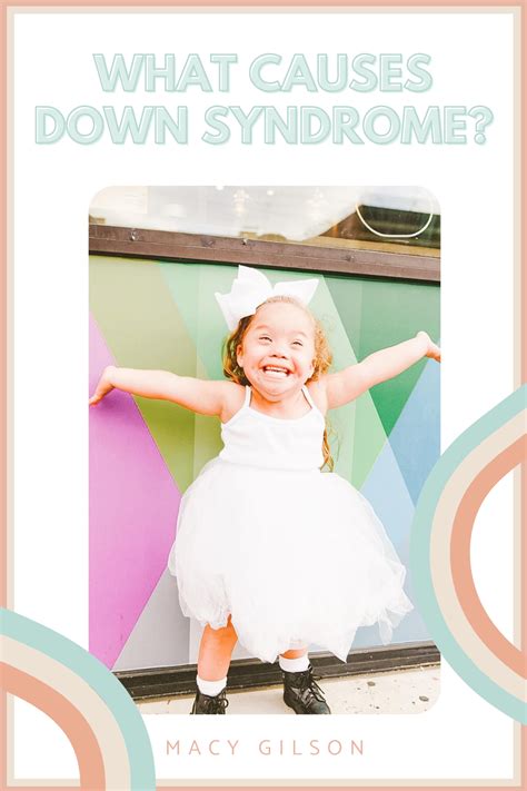 What Causes Down Syndrome Artofit