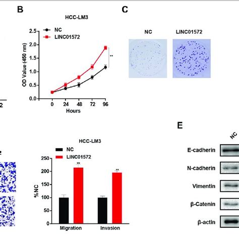 Linc01572 Overexpression Promoted The Proliferation Migration And