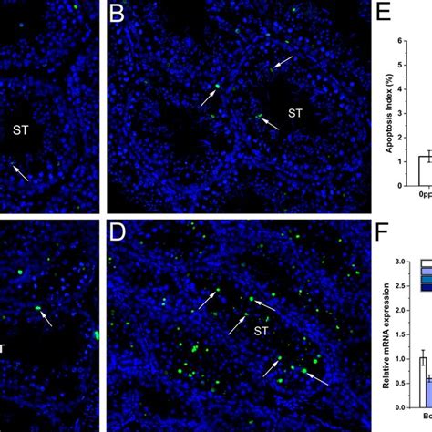 Effect Of Pb Exposure On Testicular Cells Apoptosis Detected By Tunel