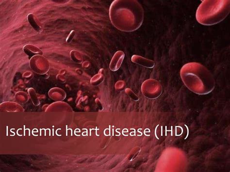 Ischemic Heart Disease Ihd Pathophysiology Types Its Causes And