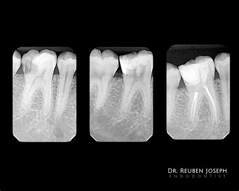 45 – RCT – TDO University