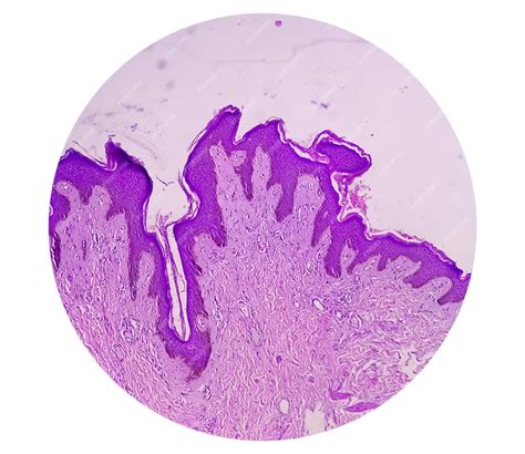 Biopsia Histológica De Pared Escrotal Bajo Microscopía Que Muestra