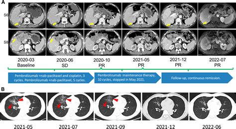 Frontiers Durable Response To The Combination Of Pembrolizumab And