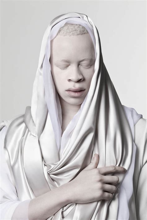 Albino Somali Girl Telegraph