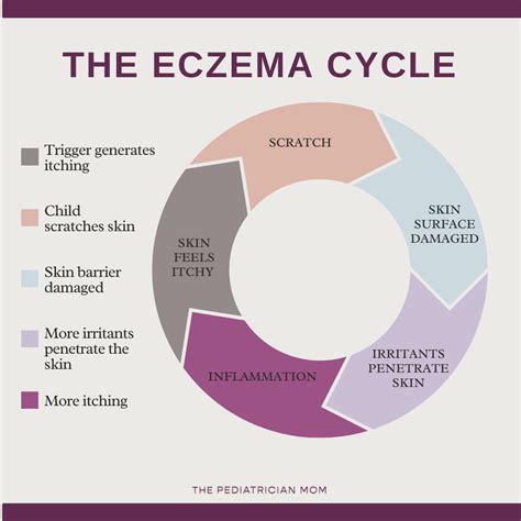 Eczema Triggers And Grading — The Pediatrician Mom