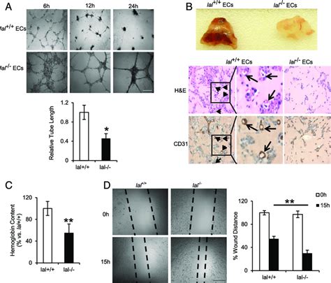 LAL Deficiency Influences EC Angiogenic Functions A In Vitro