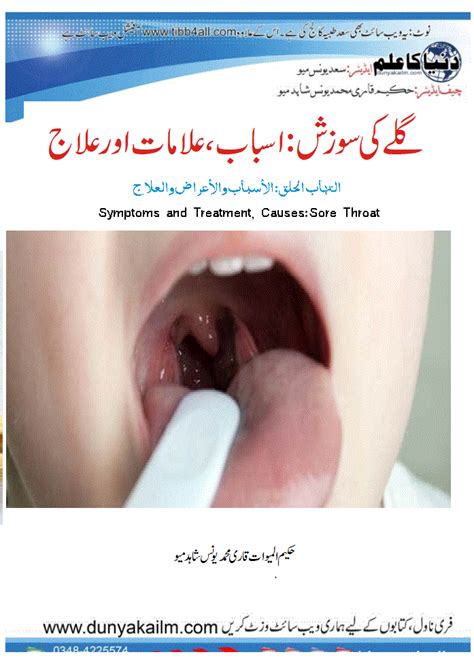 Sore Throat Causes Symptoms And Treatment Dunya Ka Ilm