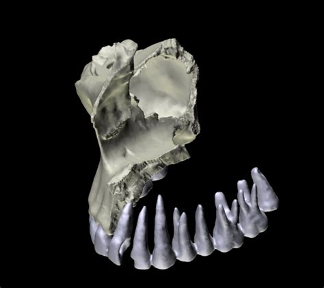 Osso Mascellare Anatomia D E Immagini Medicina