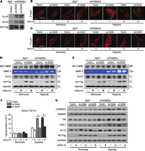 Ep3ab Mediates Rockmt1 Mmpmmp 2tgf β 1 Signaling In Pasmcs Via G α