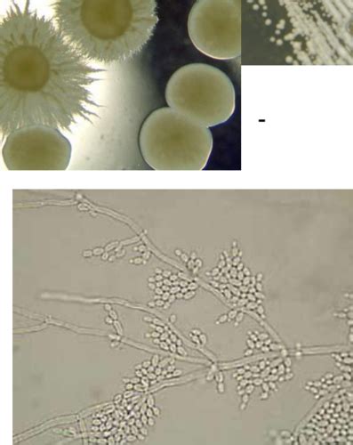 Mycology Exam 2 Flashcards Quizlet