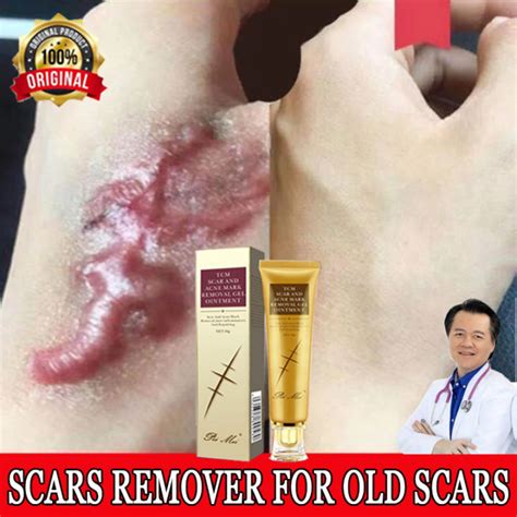 Fix Scar Removal Original Scars Remover For Old Scars Remover For Old