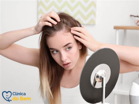 Alopecia androgenética ou areata entenda as diferenças Clínica do Bem