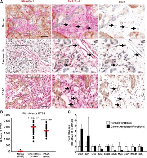 Pancreatic Cancer Cell Signaling Pathway