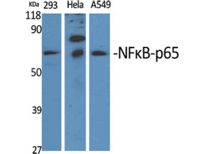 NFkappaB P65 Polyclonal Antibody MBS2536964 From MyBioSource