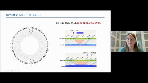 Optical Genome Mapping Unrivaled Structural Variant Detection For