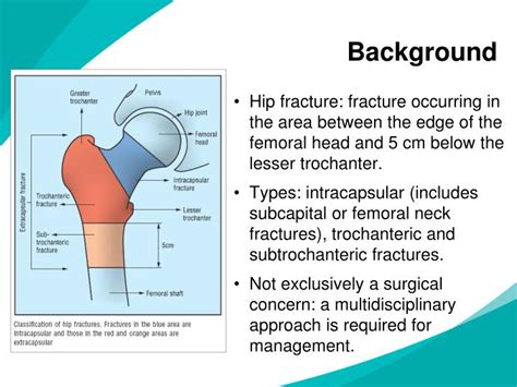 Ppt Hip Fracture Powerpoint Presentation Id