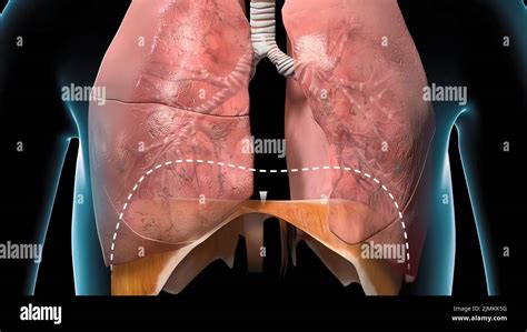 Le Diaphragme Est Une Structure Dans Le Corps Faite De Muscle Et De