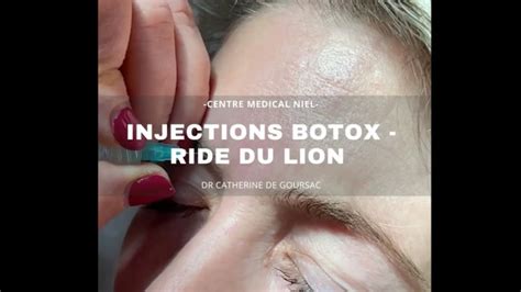 Injections Produit De Comblement Dr Catherine De Goursac Estheticon Fr