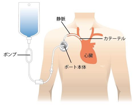 腫瘍内科 | 社会医療法人 駿甲会 コミュニティーホスピタル 甲賀病院
