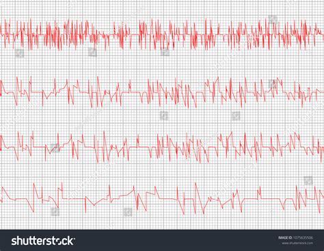 Red Heart Cardiogram Vector Charts Set Healthy Royalty Free Stock