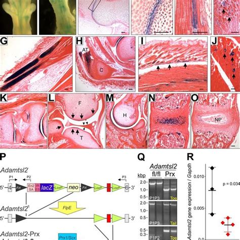 Hypertrophic Zone Expansion At The Regions Of Growth Plate Adjacent To