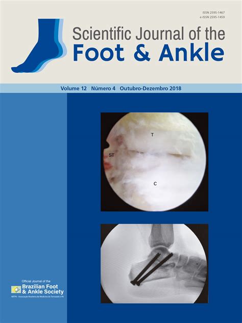 Extensive Giant Cell Tumor On The Foot Completely Wrapping The Extensor Hallucis Longus