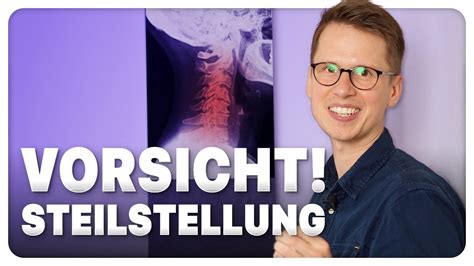 Steilstellung Der Halswirbels Ule Hws Was Ist Das Was Hilft Youtube