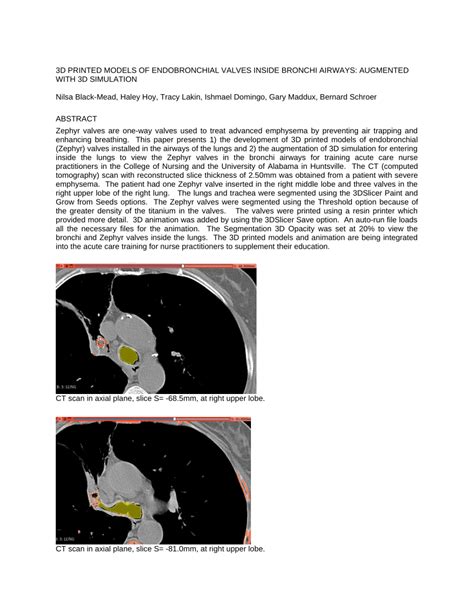 PDF 3D PRINTED MODELS OF ENDOBRONCHIAL VALVES INSIDE BRONCHI AIRWAYS